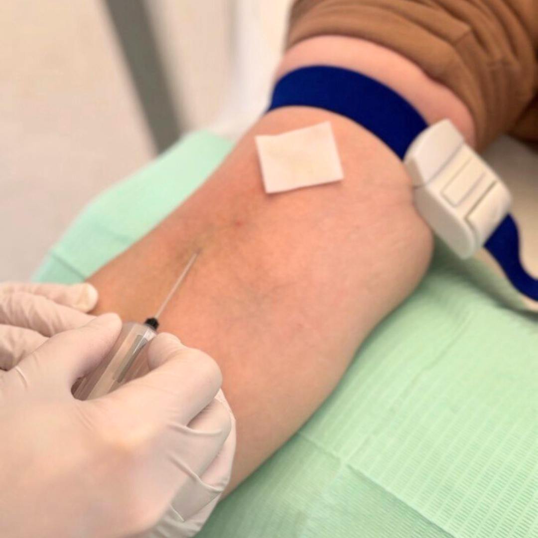 Лабораторні аналізи: